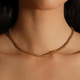 Collar de Aloa